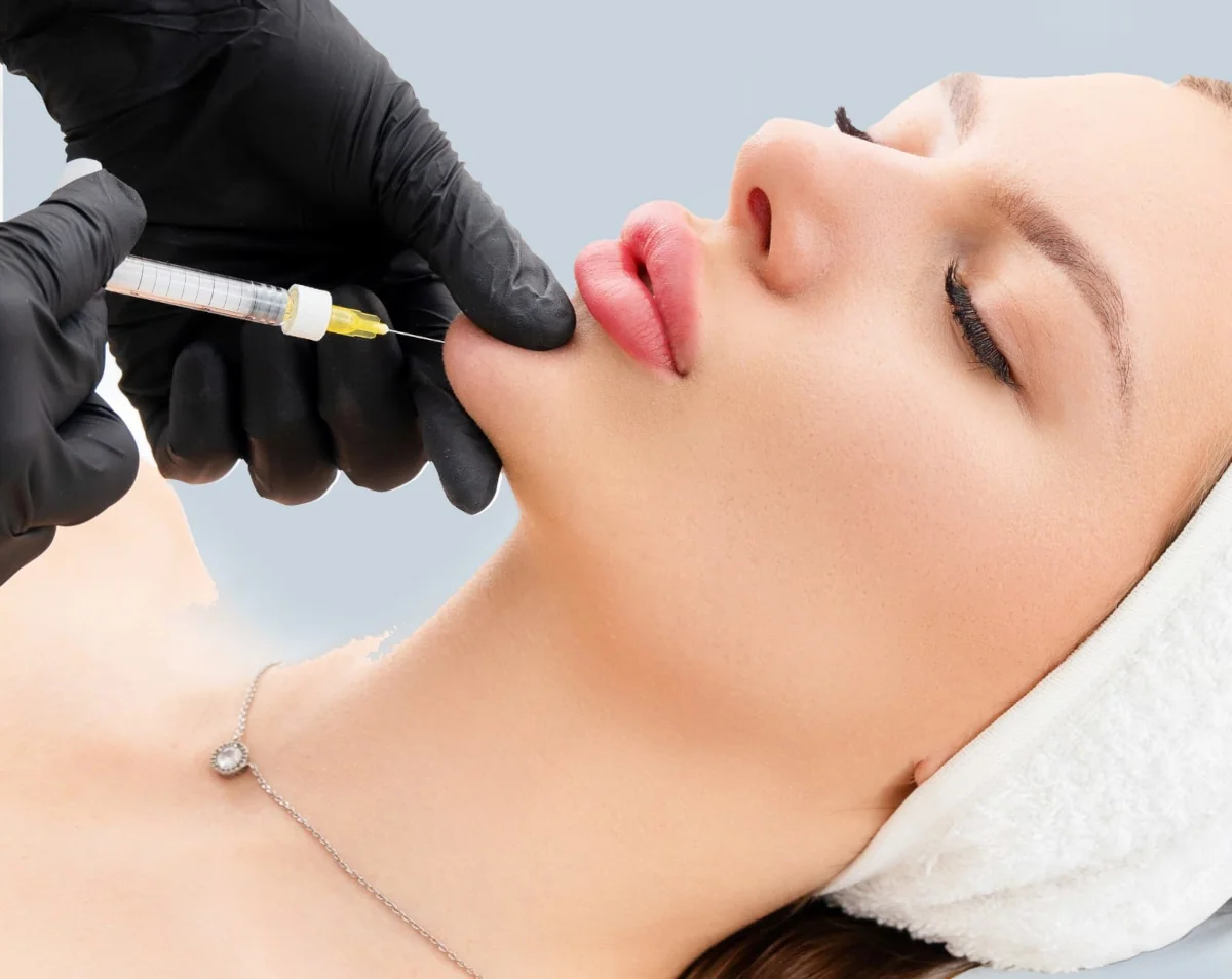 Chin enhancement with Hyaluron