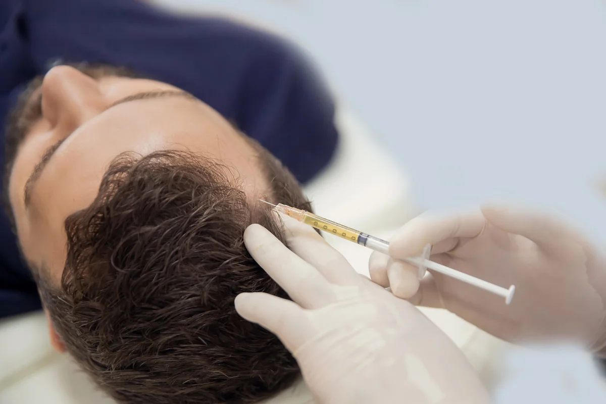 Hair growth through PRP (Platelet-Rich Plasma) autologous blood therapy Hair growth through PRP (Platelet-Rich Plasma) autologous blood therapy