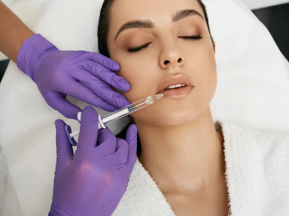 Lip augmentation with Hyaluron Lip augmentation with Hyaluron
