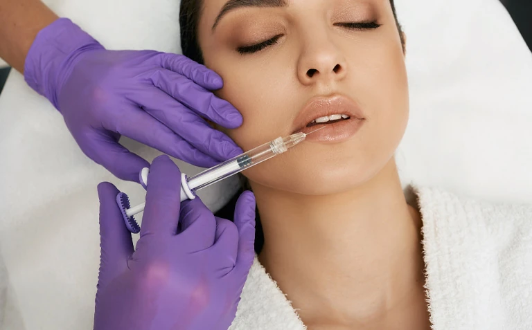 Lip augmentation with Hyaluron