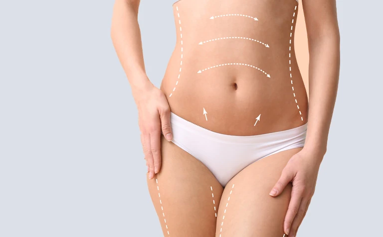 Liposuction Facetite – Bodytite and Acutite